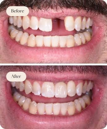 Happy Family - Pediatric Dentistry Uttam Nagar New Delhi